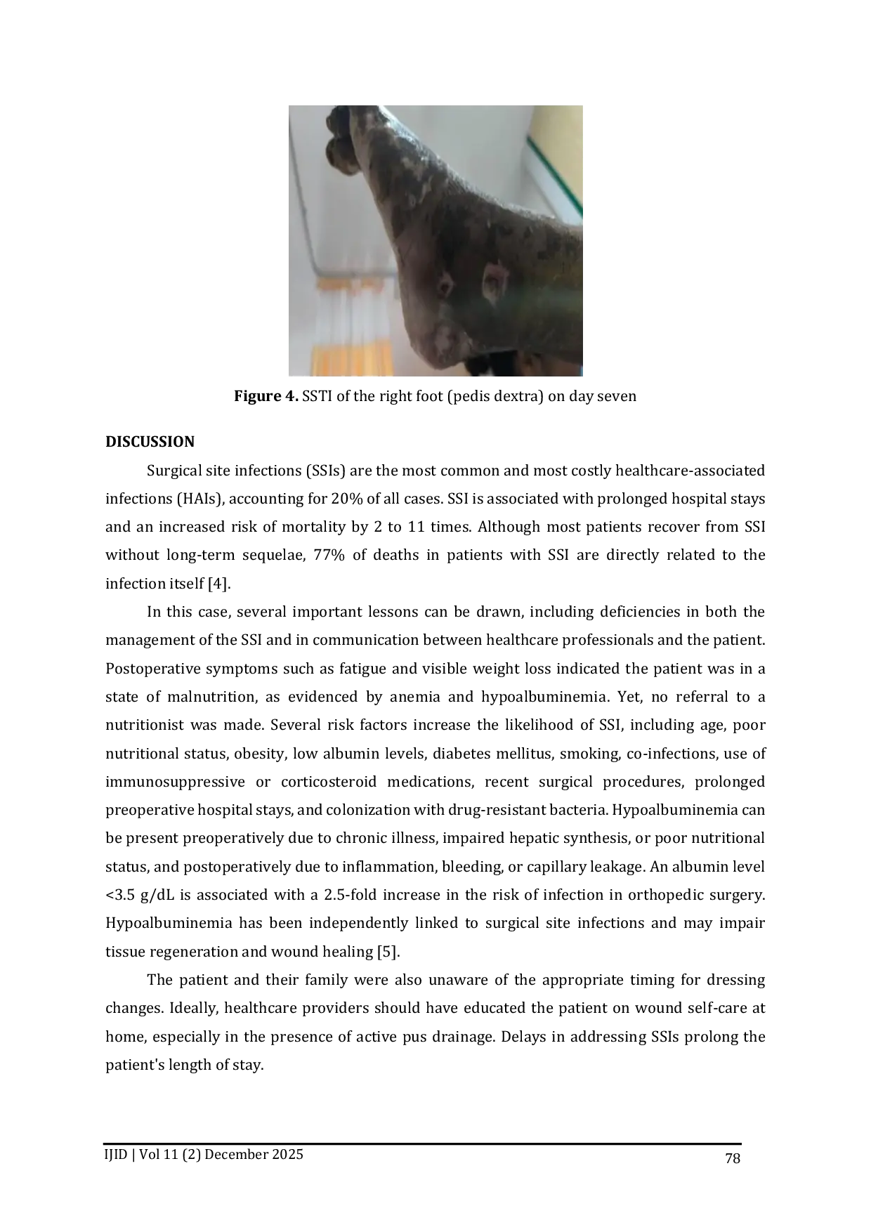 JURIS Infeksi Luka Operasi Yang Diabaikan Karena Acinetobacter Baumannii Dan Klebsiella Pneumoniae Multiresisten