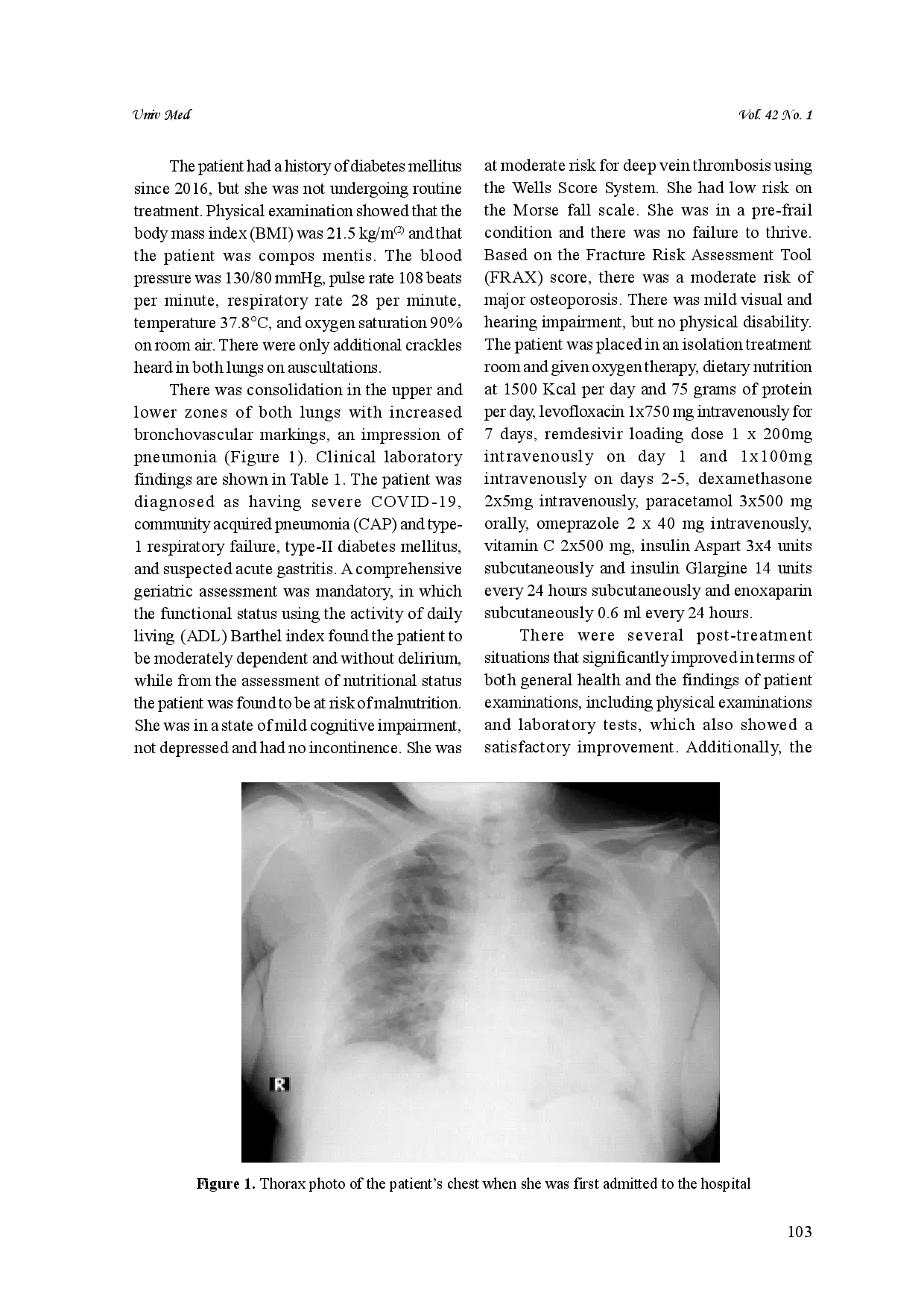 juris COVID 19 and the ageing immune system in an elderly patient a case report