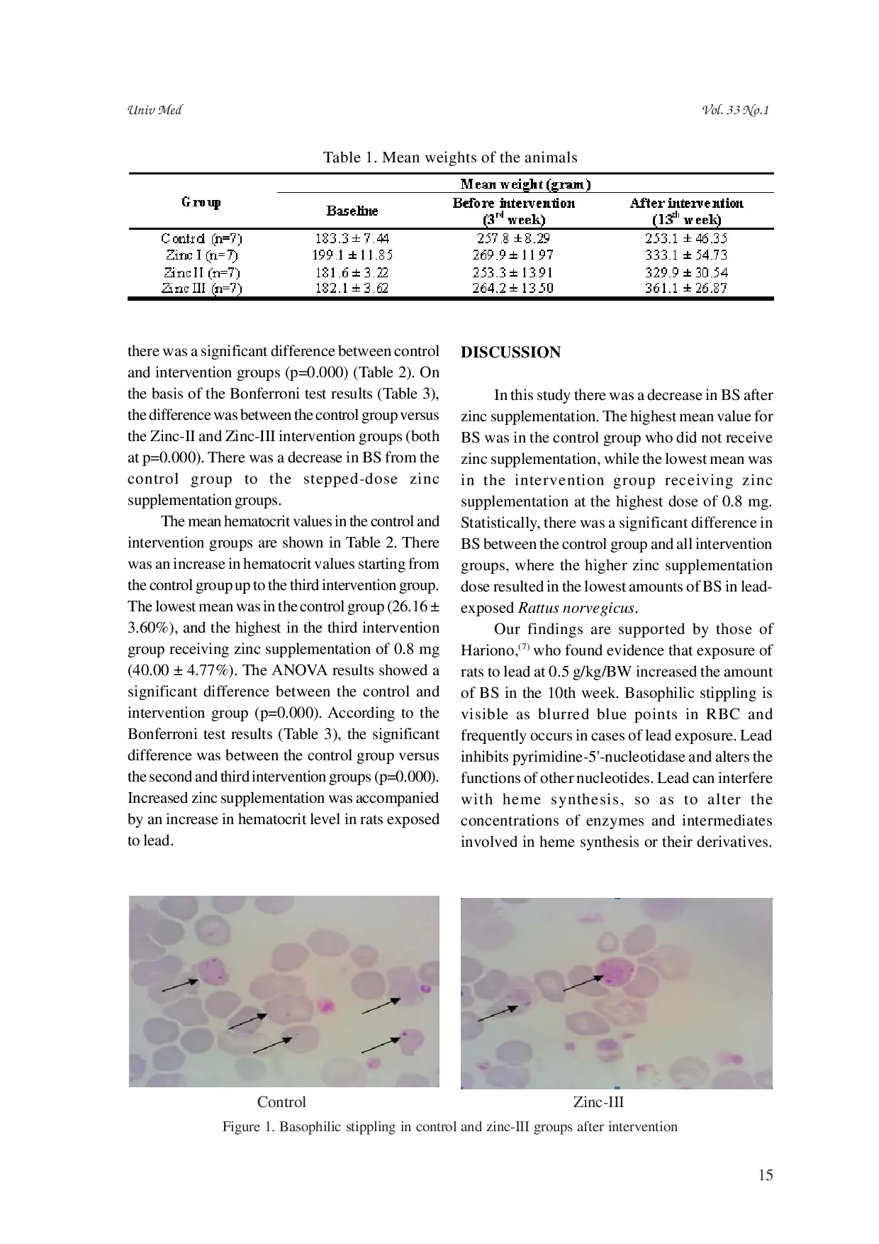 juris Zinc supplementation decreases basophilic stippling in rats exposed to lead
