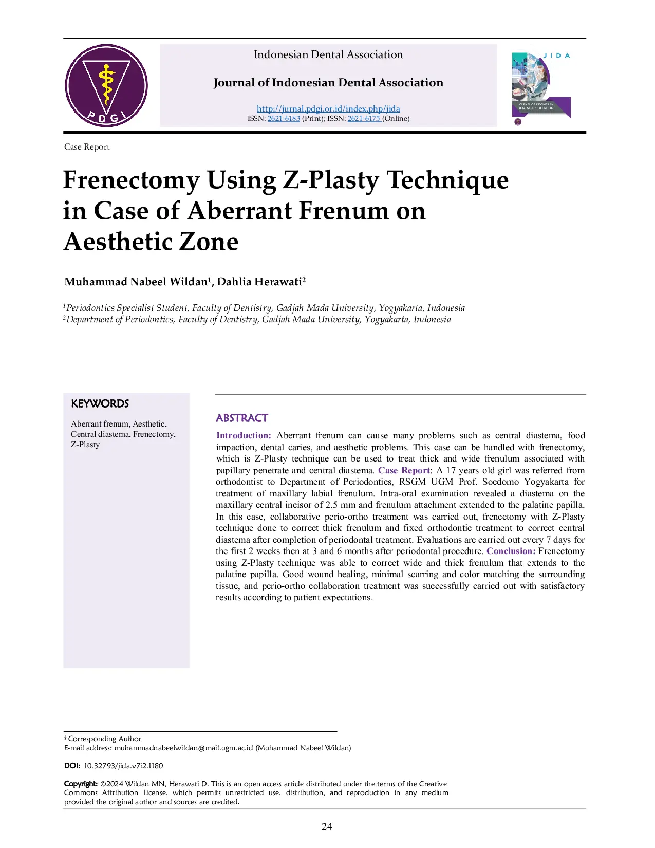 JURIS Frenectomy Using Z Plasty Technique in Case of Aberrant Frenum on Aesthetic Zone