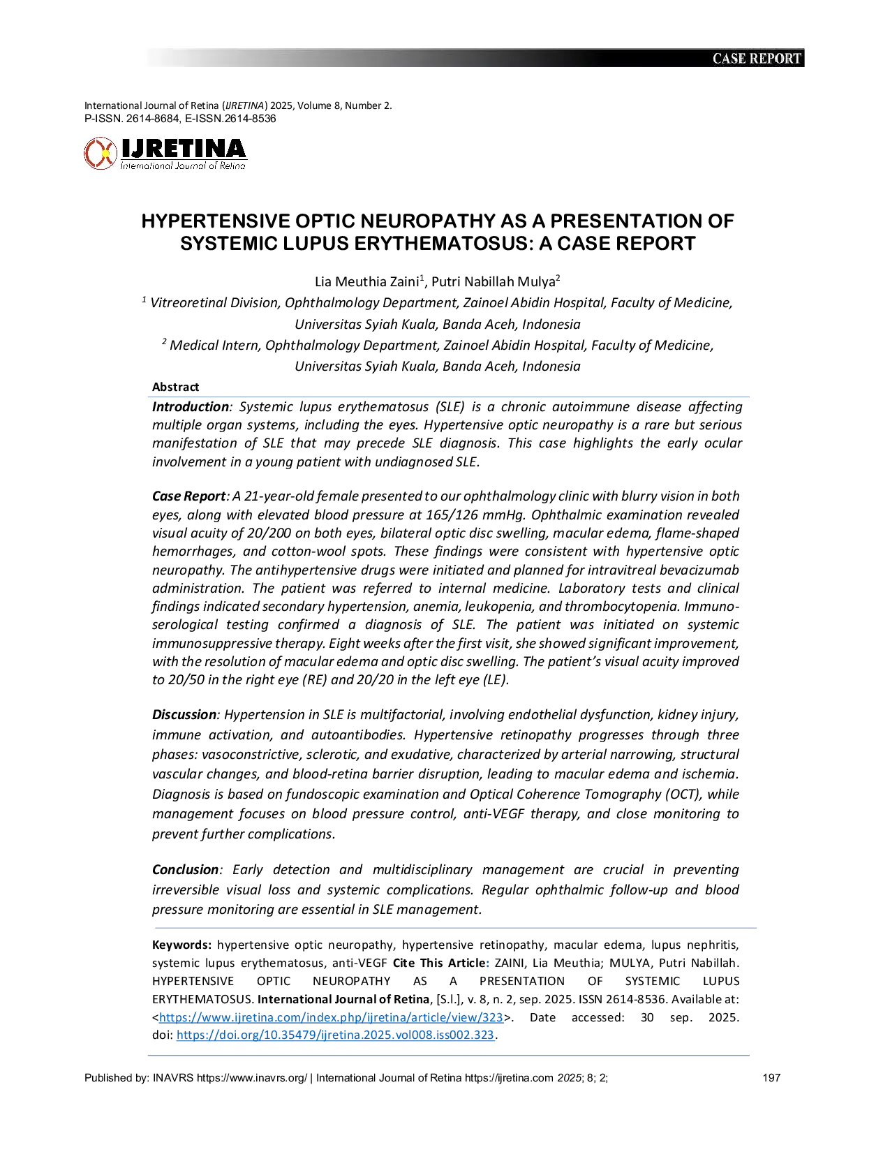 JURIS Hypertensive Optic Neuropathy As A Presentation Of Systemic Lupus Erythematosus A Case Report