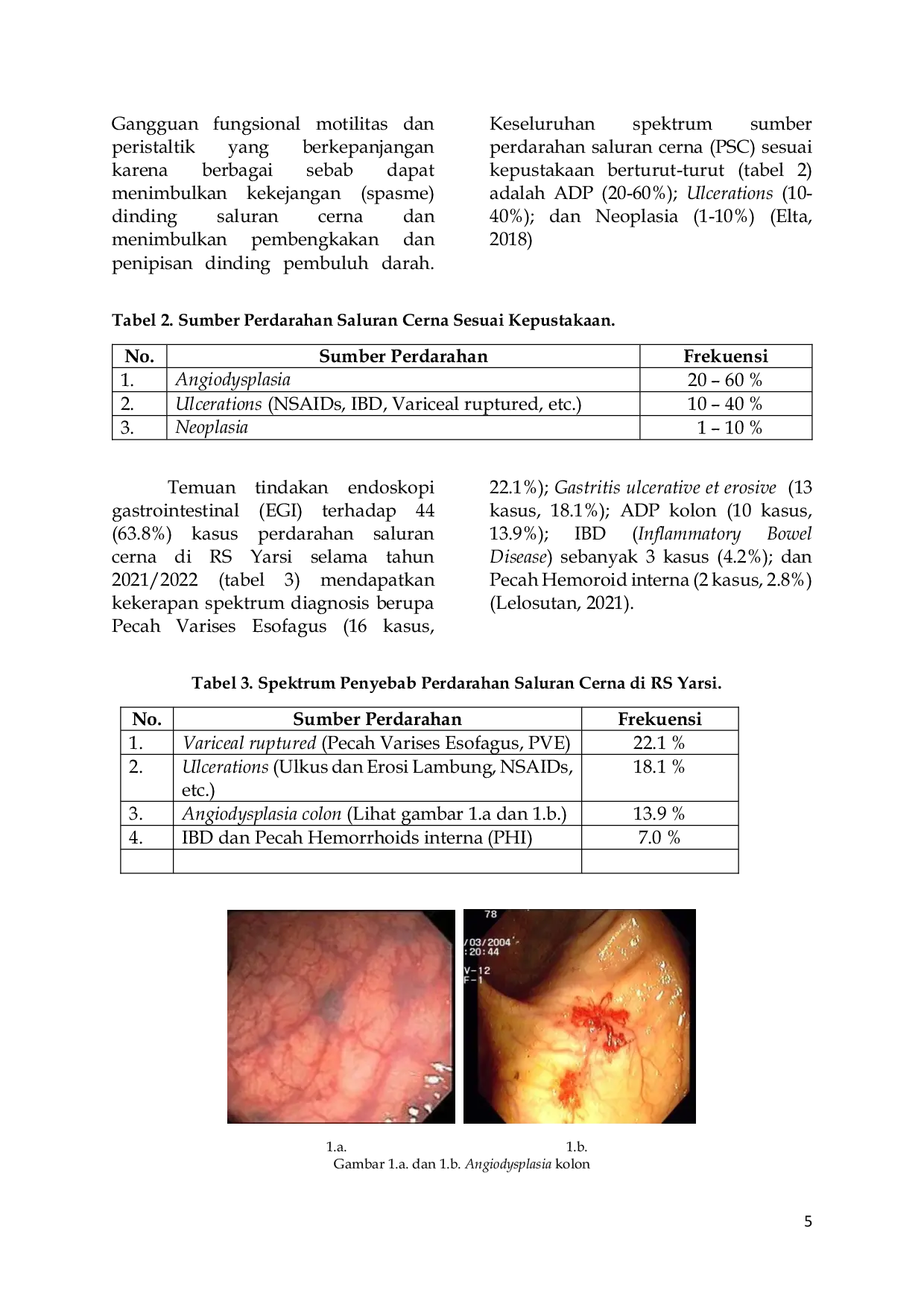 JURIS Kekerapan Angiodysplasia dan Penatalaksanaannya di RS Yarsi Jakarta