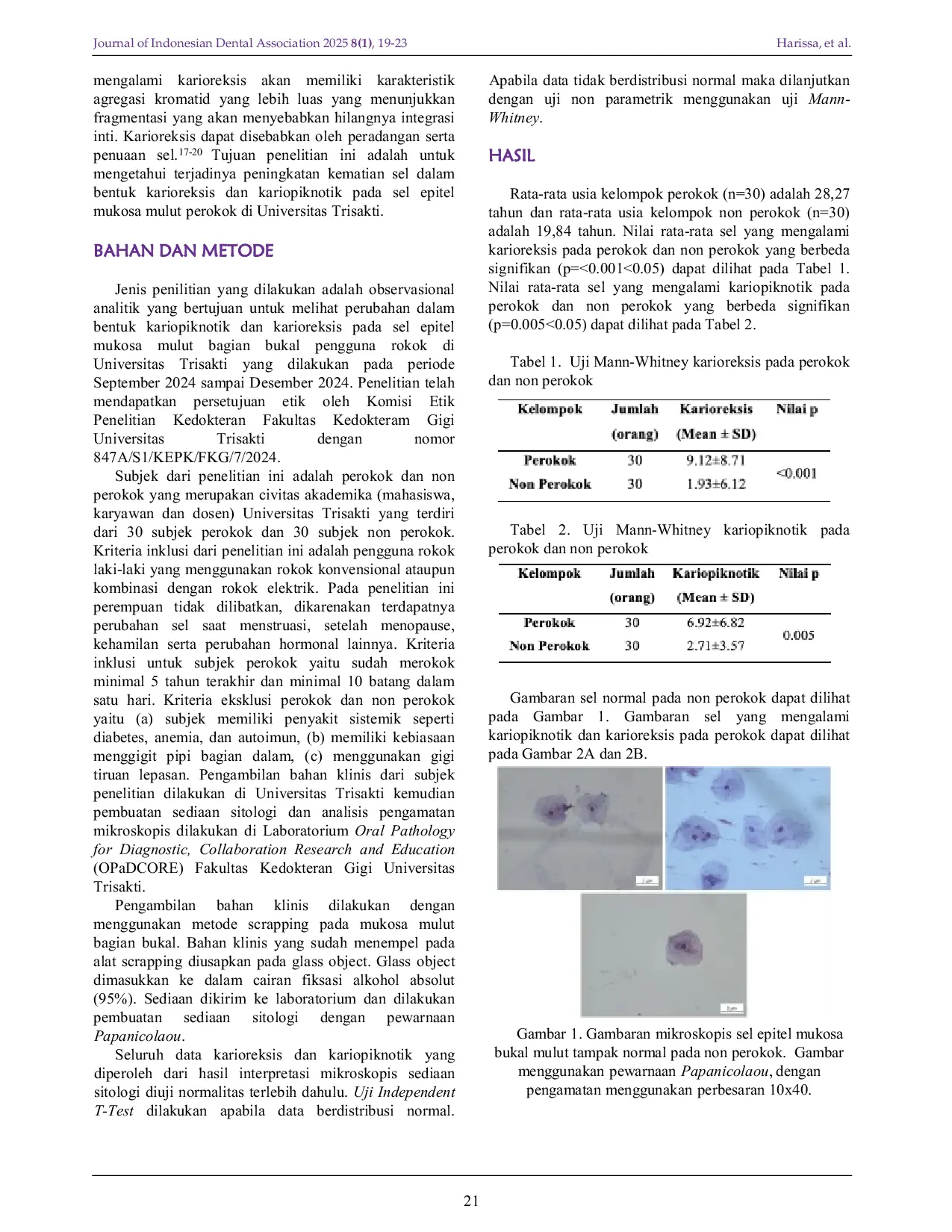 JURIS Nuclear Changes in the Form of Karyorrhexis and Karyopyknosis in Oral Mucosal Epithelial Cells of Smokers