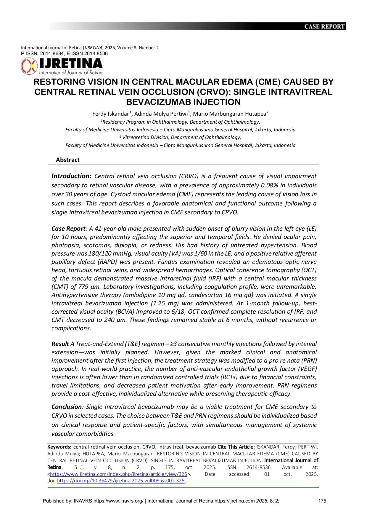 JURIS Restoring Vision in Central Macular Edema CME Caused by Central Retinal Vein Occlusion CRVO Single Intravitreal Bevacizumab Injection