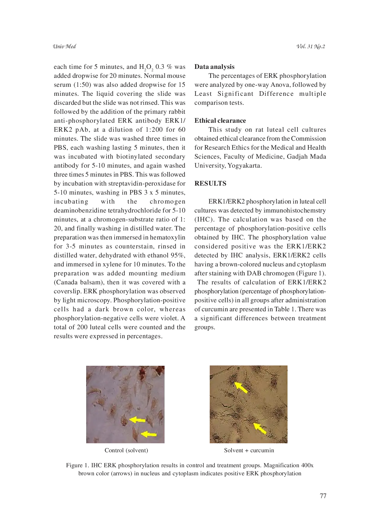 JURIS Curcumin inhibits luteal cell steroidogenesis by suppression of extracellular signal regulated kinase