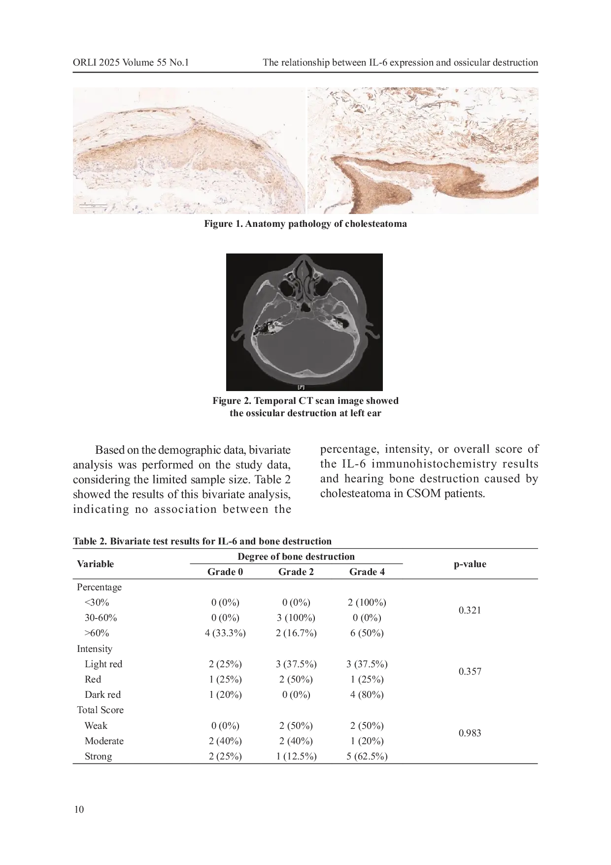 JURIS Hubungan Ekspresi IL 6 dengan Kerusakan Tulang Pendengaran pada OMSK dengan Kolesteatoma