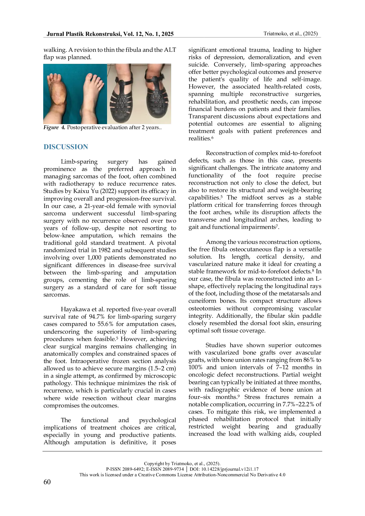 JURIS A Successful Limb Sparing Approach In Synovial Sarcoma Of The Foot A Case Report