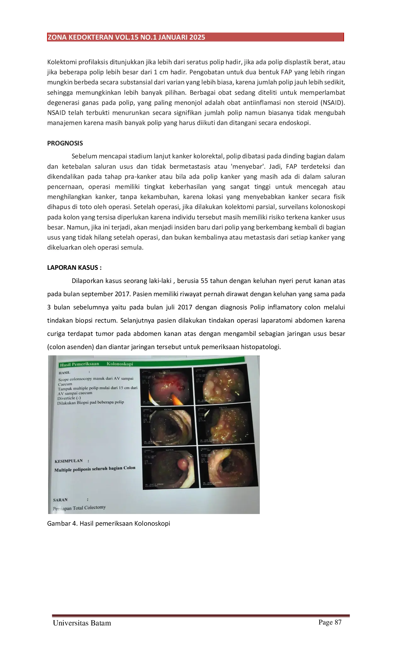 JURIS Familial Adenomatous Polyposis Leading to Adenocarcinoma A Case Analysis