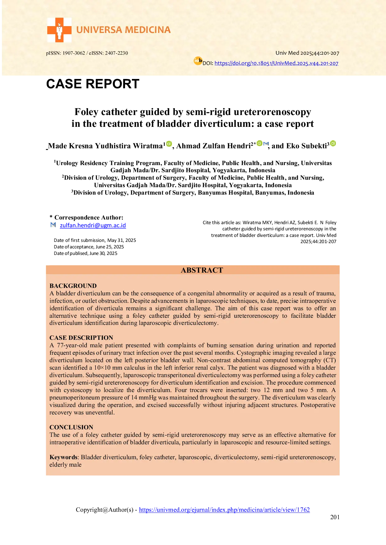 JURIS Foley Catheter Guided by Semi Rigid Ureterorenoscopy in the Treatment of Bladder Diverticulum A Case Report