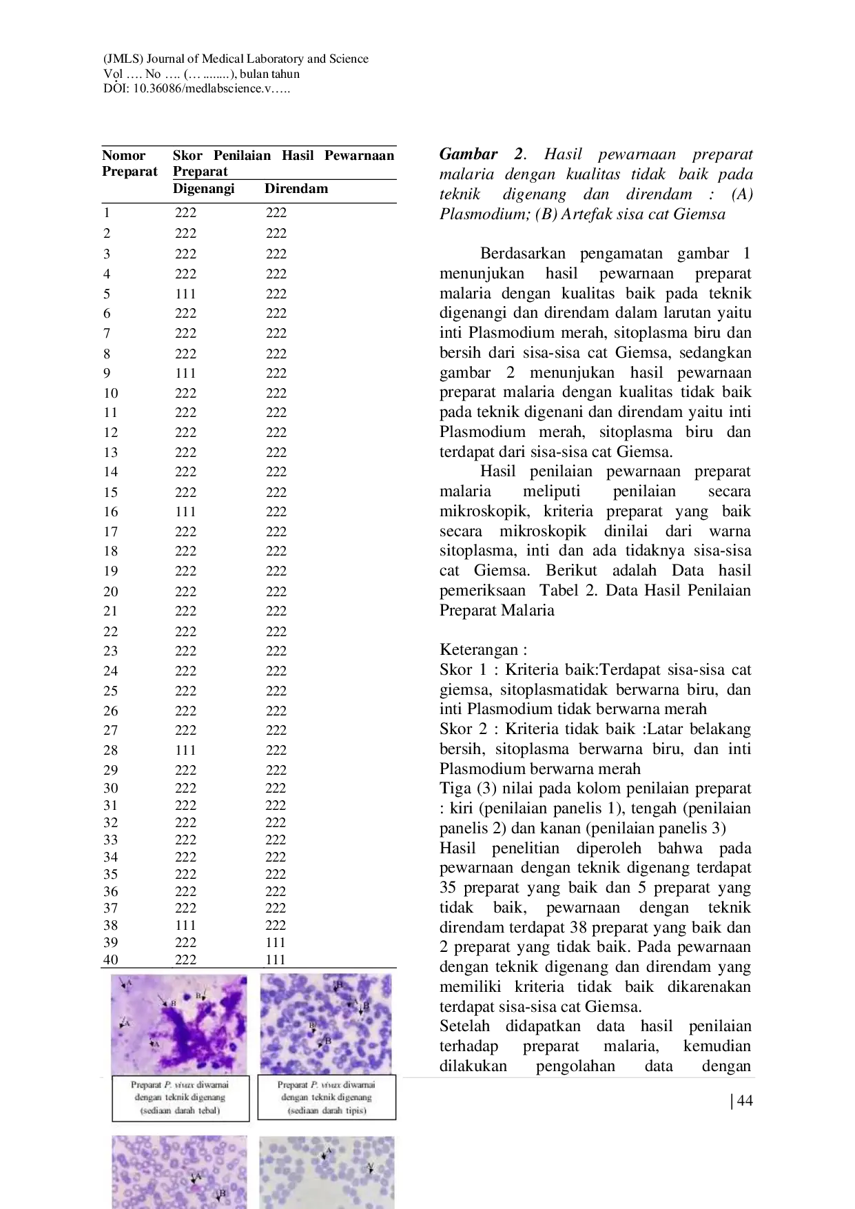 JURIS The COMPARISON OF THE QUALITY OF MALARIA PREPARATIONS FLOODED WITH SOAKED IN GIEMSA SOLUTION