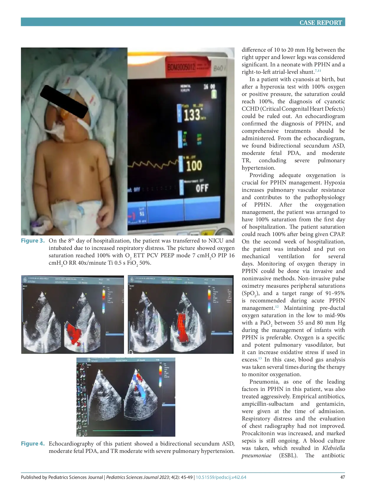 juris Comprehensive management for the improved outcome of persistent pulmonary hypertension of the newborn in a one day old baby girl a case report