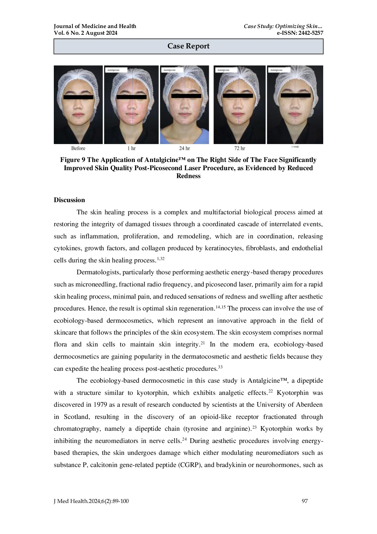 JURIS Case Study Optimizing Skin Regeneration After Aesthetic Procedures with Dermocosmetic Skin Healing Care