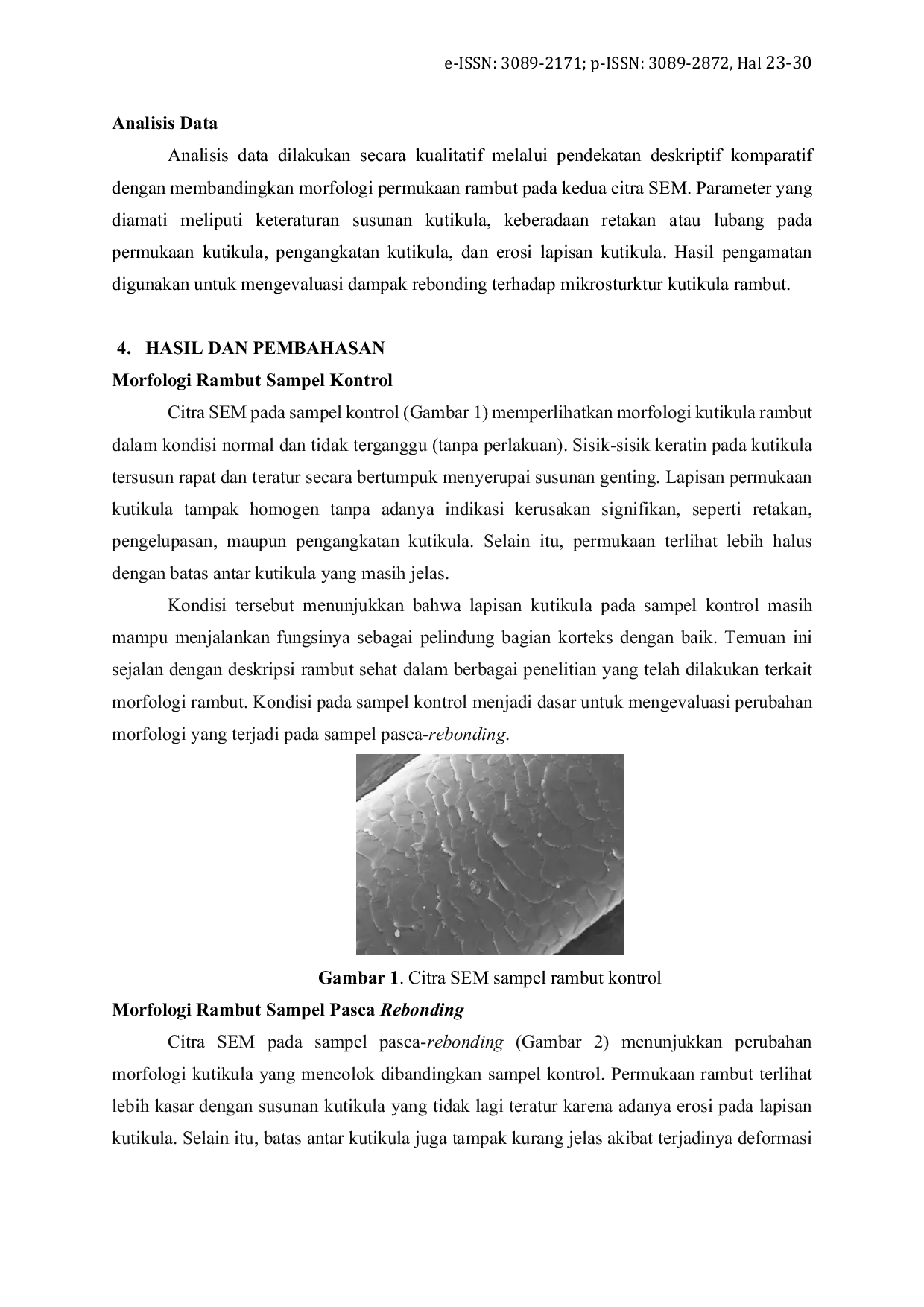 JURIS Analisis Morfologi Rambut Sebelum Dan Sesudah Rebonding Menggunakan Scanning Electron Microscopy Sem