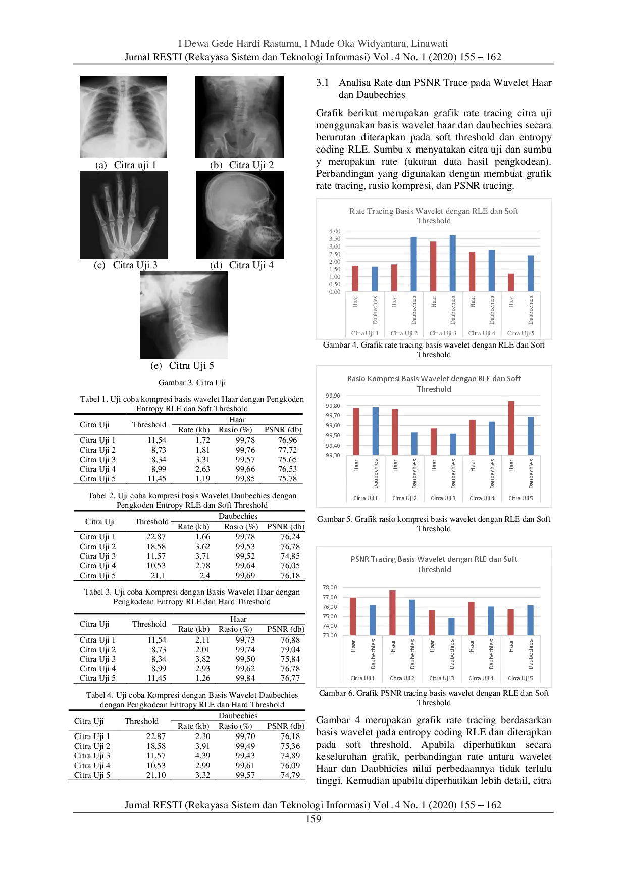 JURIS Teknik Kompresi Citra Medis dengan Transformasi Diskrit Wavelet dan Pengkodean Entropy
