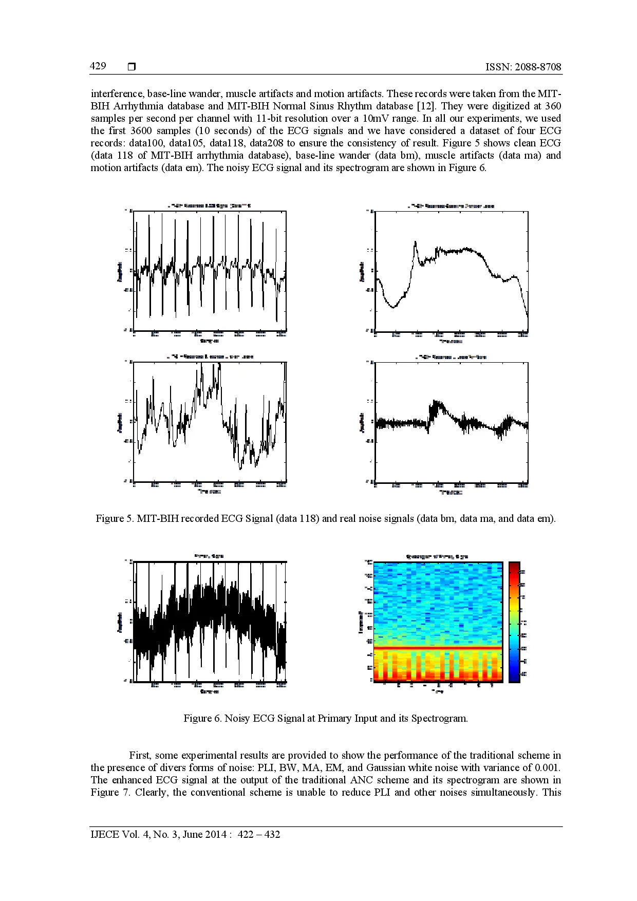 juris Low Complexity Adaptive Noise Canceller For Mobile Phones Based Remote Health Monitoring
