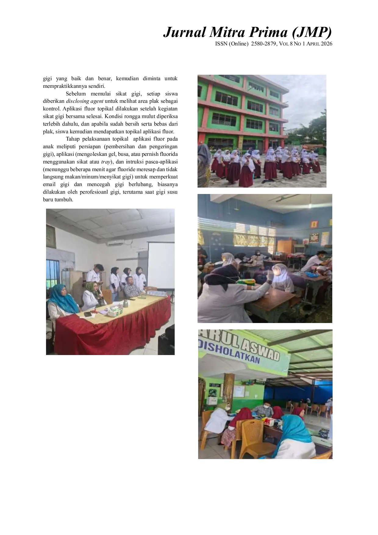 JURIS Pemberian Penyuluhan dan Topikal Aplikasi Fluor TAF Sebagai Upaya Pencegahan Karies Gigi Pada Anak SD IT Cendekia Medan 2025