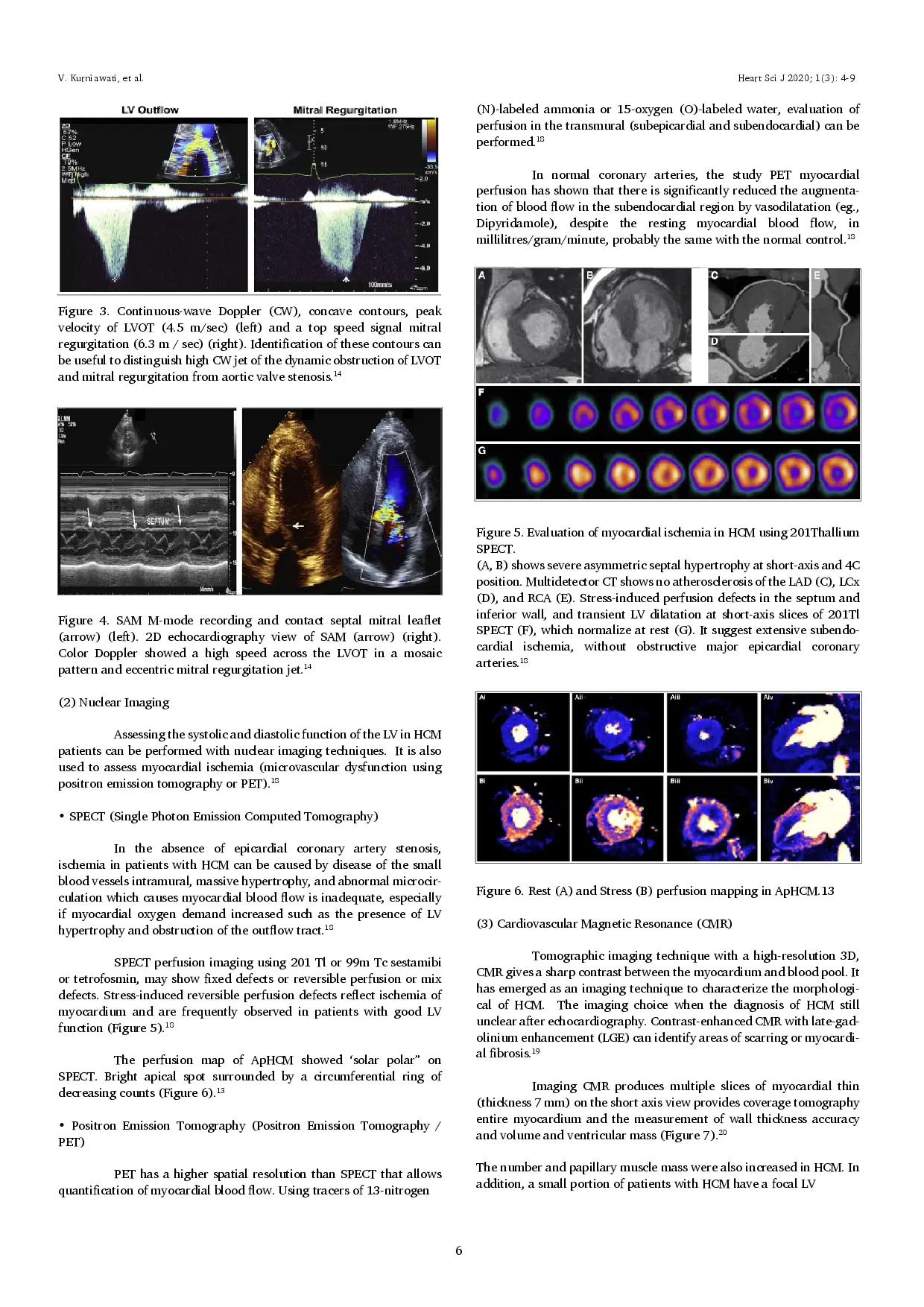 juris Multimodality Cardiovascular Imaging of Hyperthrophic Cardiomyopathy A Review Article