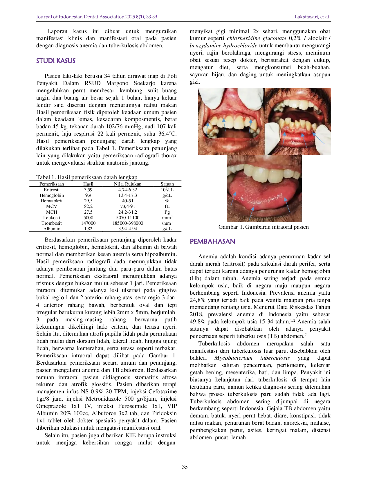 JURIS Atrophic glossitis and recurrent aphthous stomatitis in patients with anemia and abdominal tuberculosis