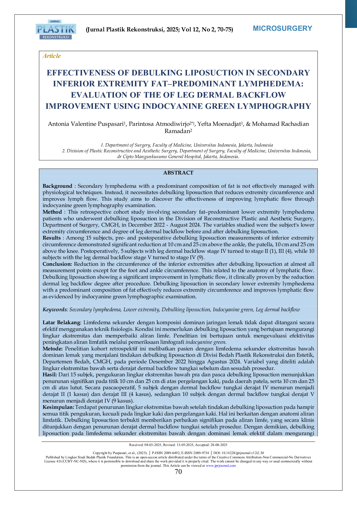 JURIS Effectiveness of Debulking Liposuction in Secondary Inferior Extremity Fat Predominant Lymphedema Evaluation of the of Leg Dermal Backflow Improvement Using Indocyanine Green Lymphography