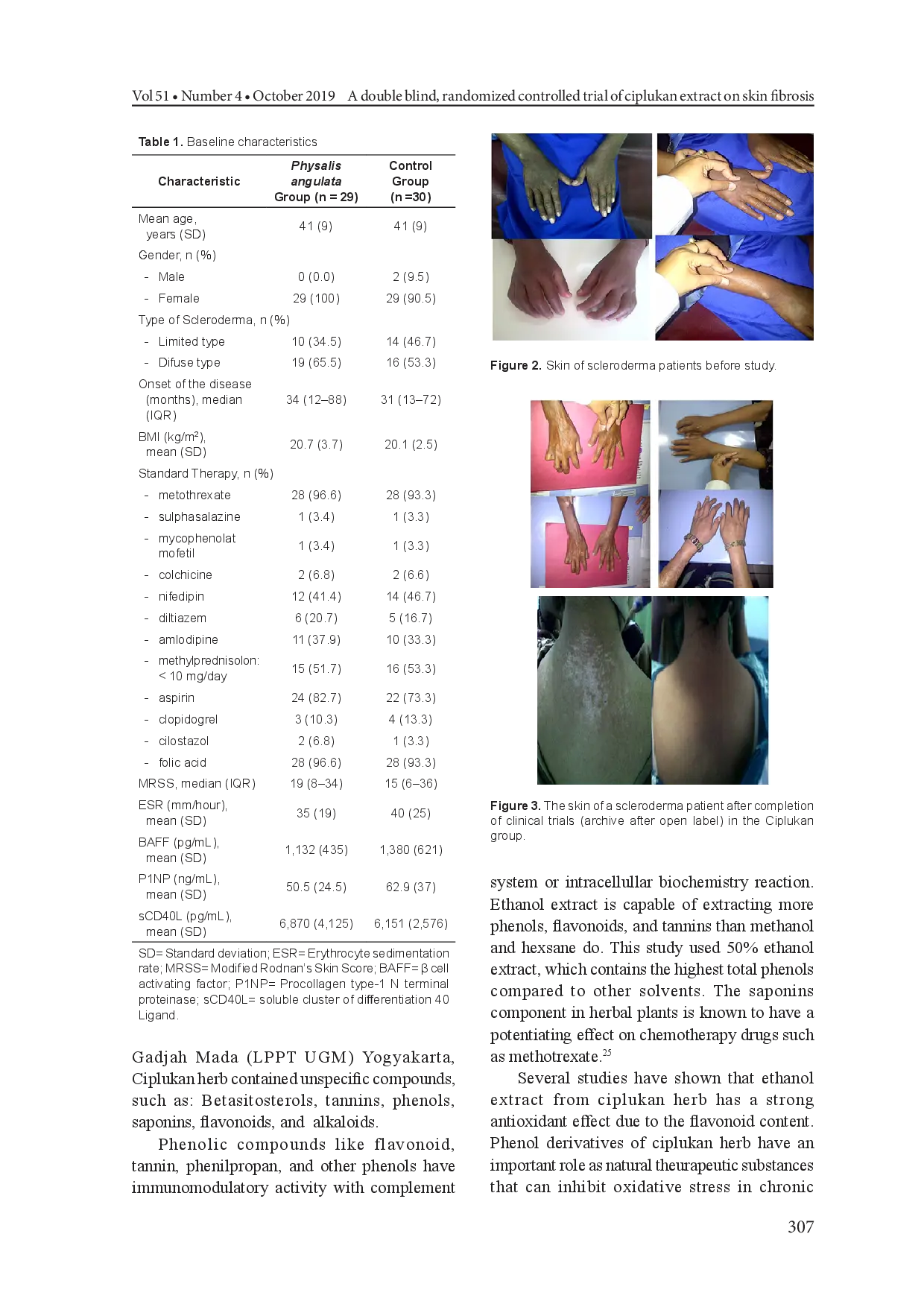 juris A Double blind Randomized Controlled Trial of Ciplukan Physalis angulata Linn Extract on Skin Fibrosis Inflammatory Immunology and Fibrosis Biomarkers in Scleroderma Patients