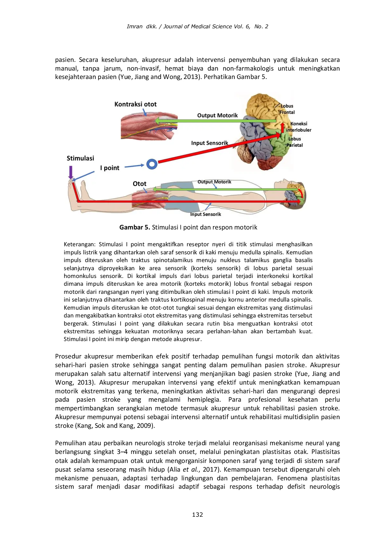 JURIS Pengaruh Stimulasi I Point terhadap Keluaran Stroke Iskemik The Effect of I Point Stimulation on Ischemic Stroke Outcome