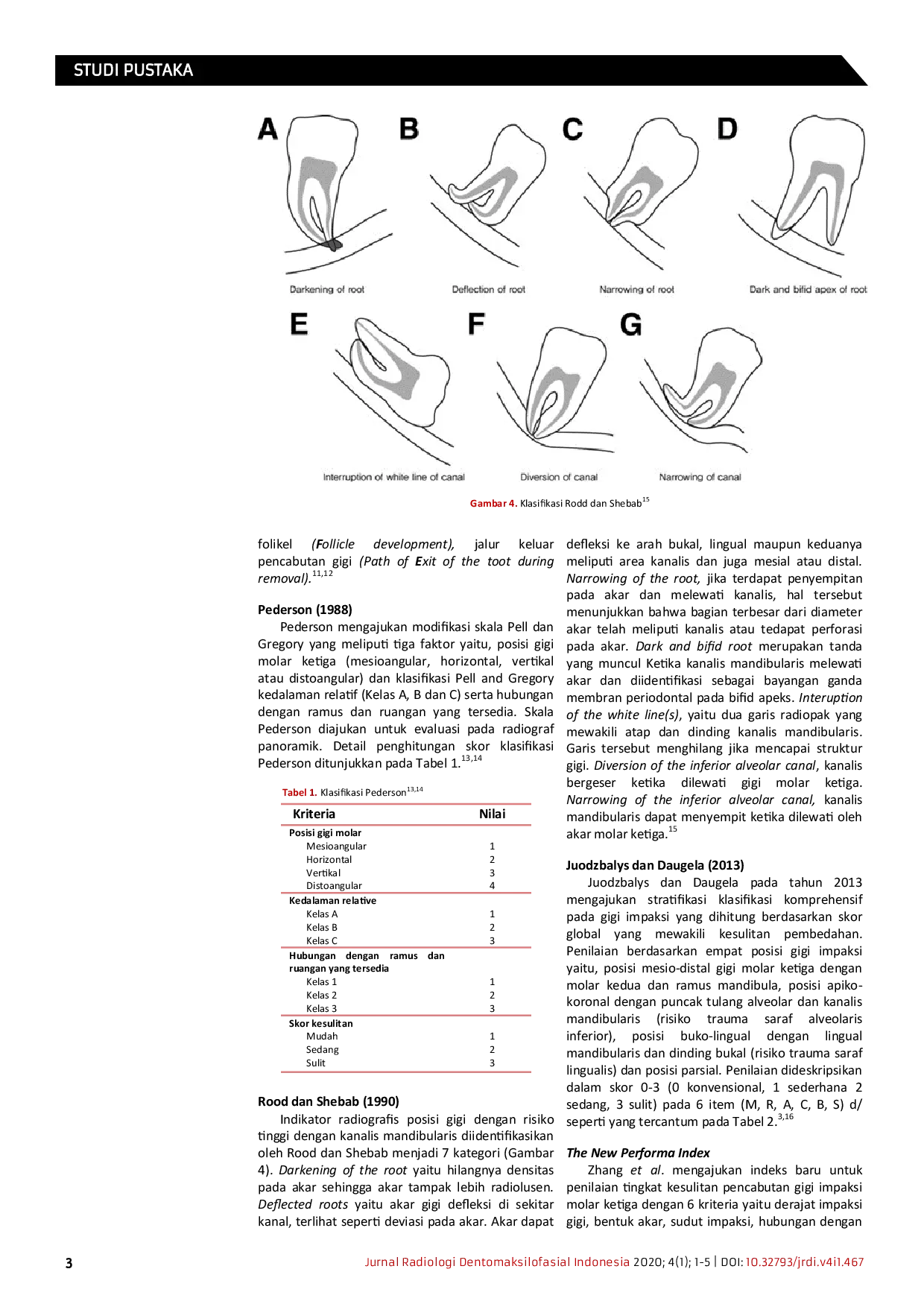 JURIS Klasifikasi impaksi gigi molar ketiga melalui pemeriksaan radiografi sebagai penunjang odontektomi