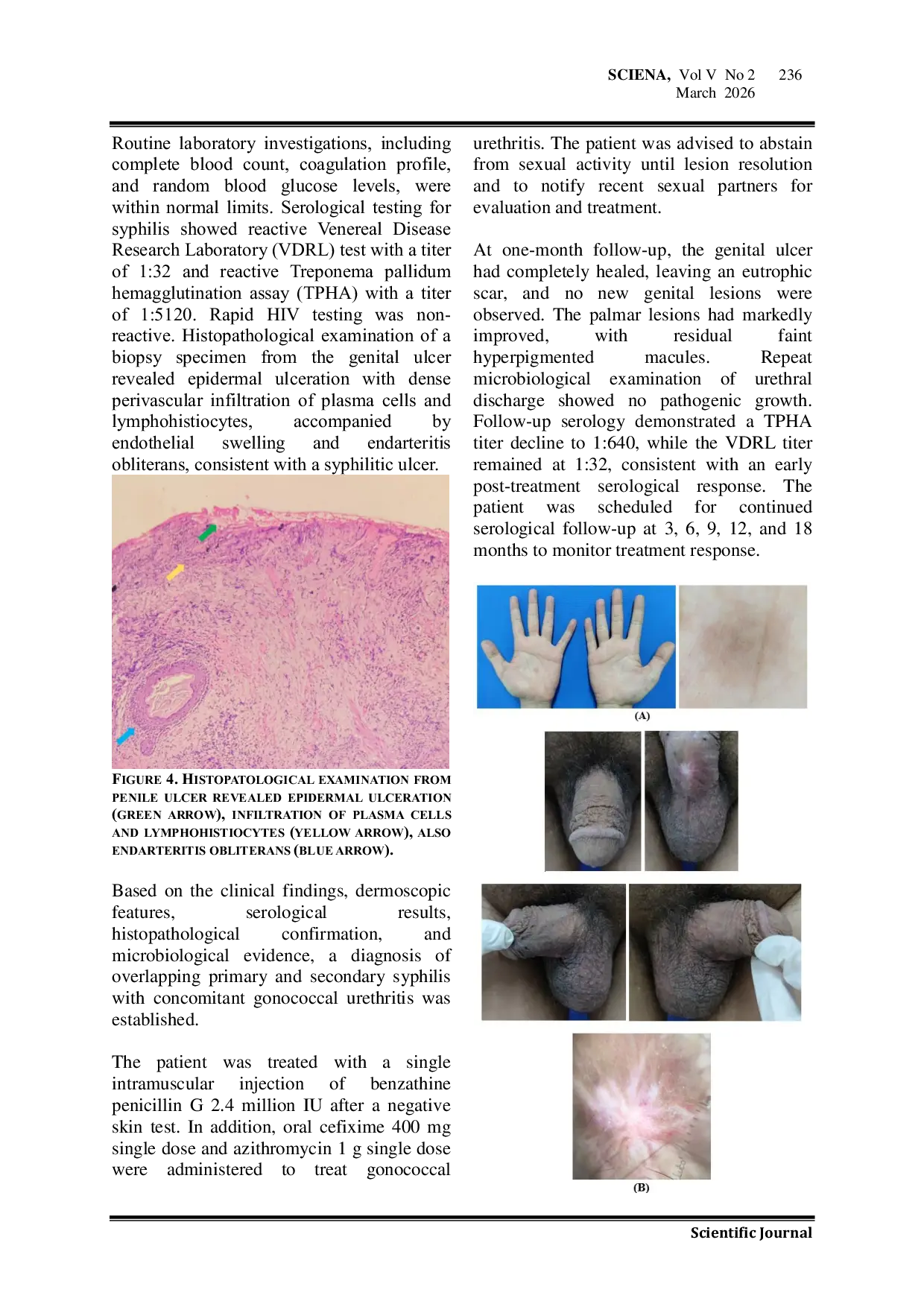 JURIS Overlapping Chancre and Syphilitic Roseola in an Immunocompetent Patient A Case Report