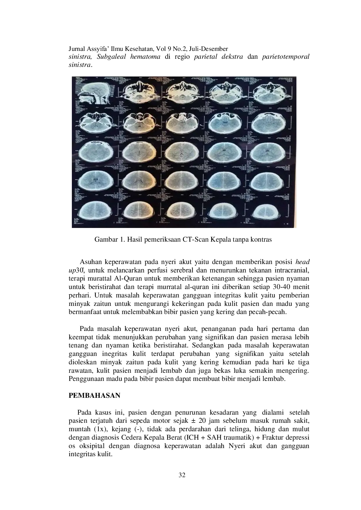 JURIS Penanganan Masalah Keperawatan Nyeri Akut dan Gangguan Integritas Kulit Pada Pasien Dengan Cedera Kepala Berat Studi Kasus