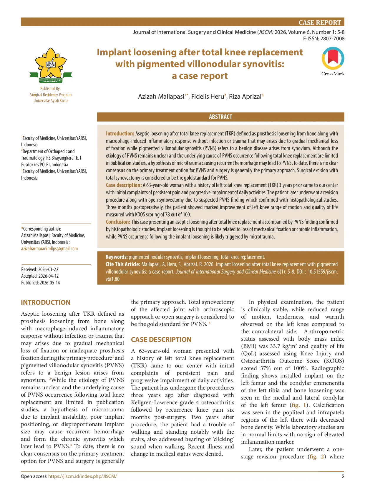 JURIS Implant loosening after total knee replacement with pigmented villonodular synovitis a case report