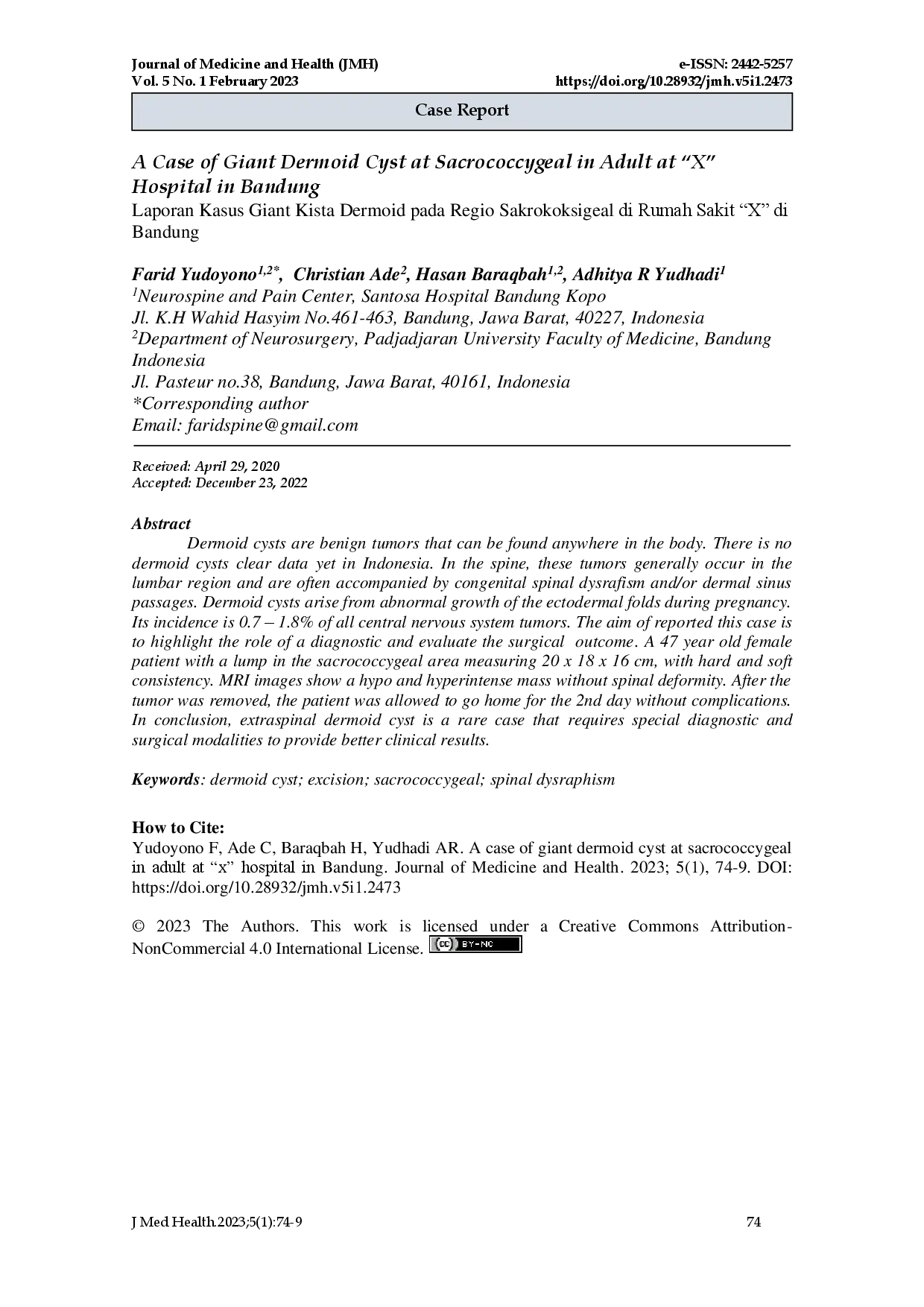 juris A Case of Giant Dermoid Cyst at Sacrococcygeal in Adult at X Hospital in Bandung