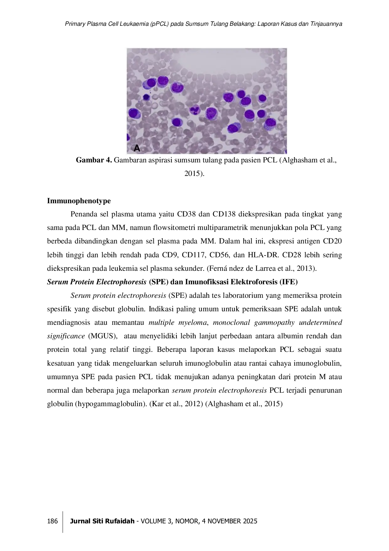 JURIS Primary Plasma Cell Leukaemia pPCL pada Sumsum Tulang Belakang Laporan Kasus dan Tinjauannya