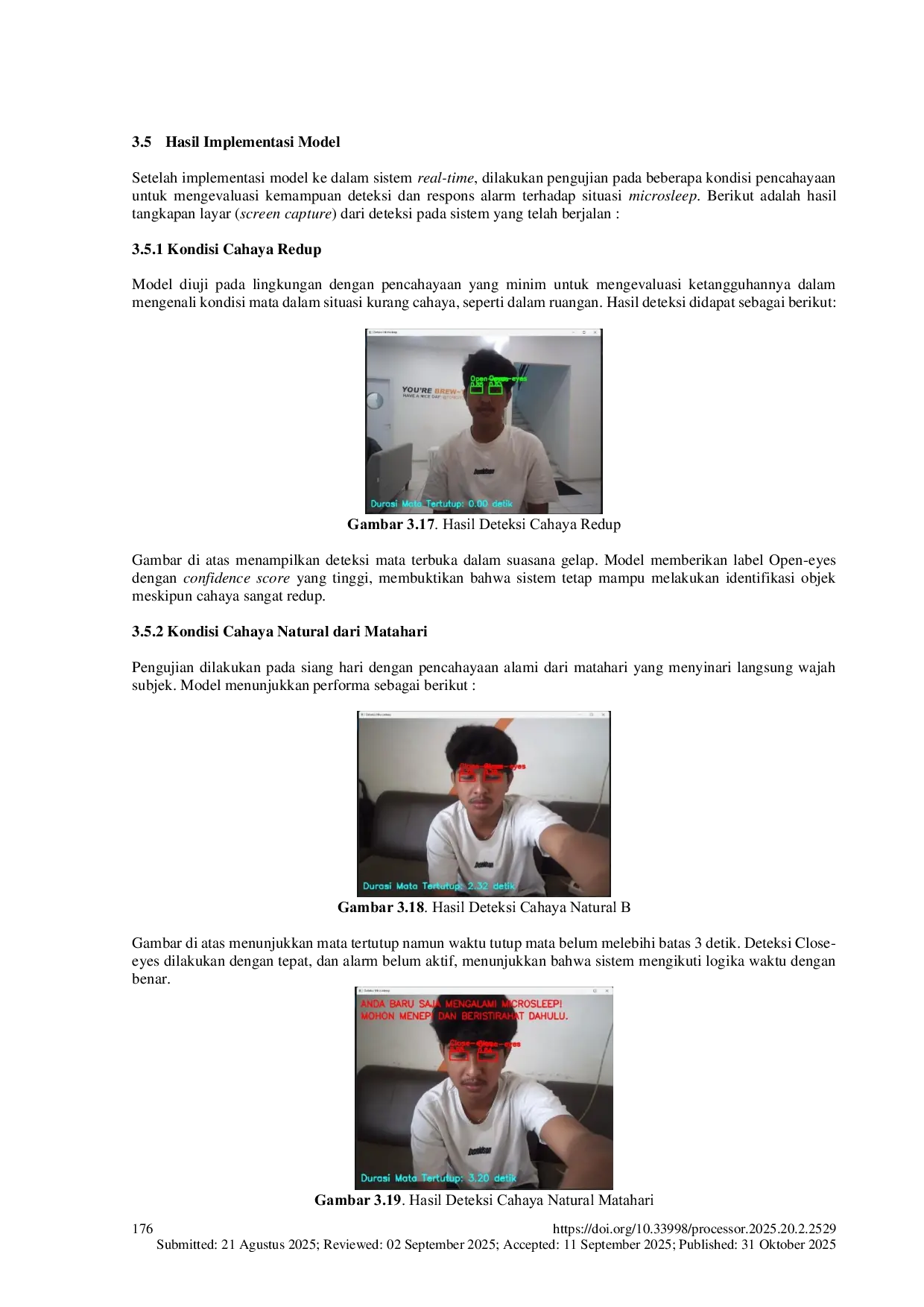 JURIS Deteksi Dini Microsleep Pada Pengemudi Kendaraan Roda Empat Melalui Citra Mata Menggunakan Algoritma YOLOv8