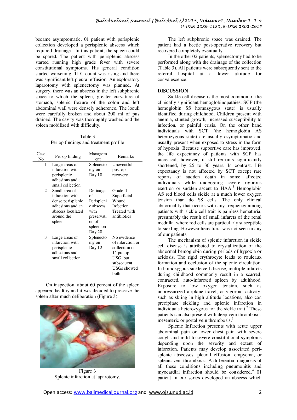 juris SPLENIC INFARCTION an intriguing and important cause of pain abdomen in high altitude