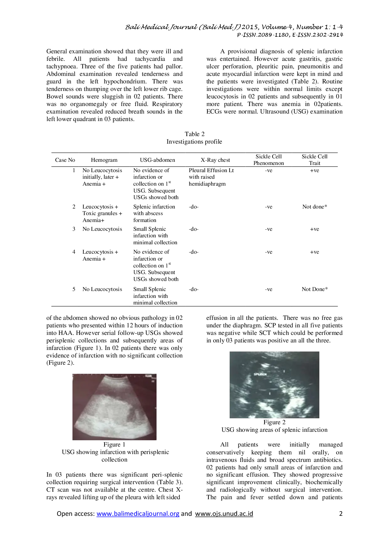 juris SPLENIC INFARCTION an intriguing and important cause of pain abdomen in high altitude