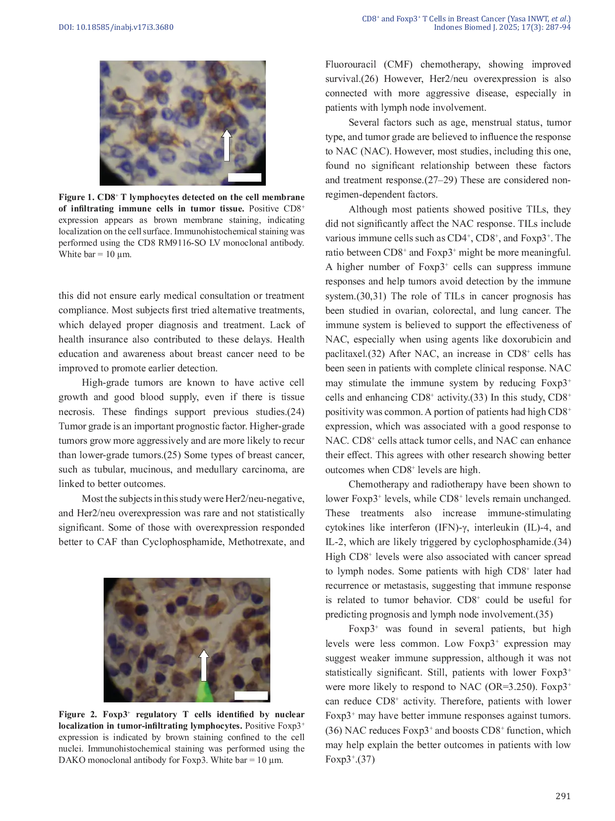 JURIS Expression of CD8 and Foxp3 T Lymphocyte as Predictor for Response to Neoadjuvant Chemotherapy in Stage III Breast Cancer