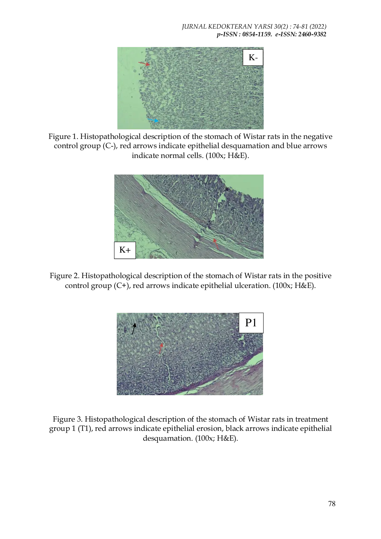 JURIS Effect of Plantain Floret Extract on Gastric Histopathological Analysis on Wistar Rats Given Ethanol