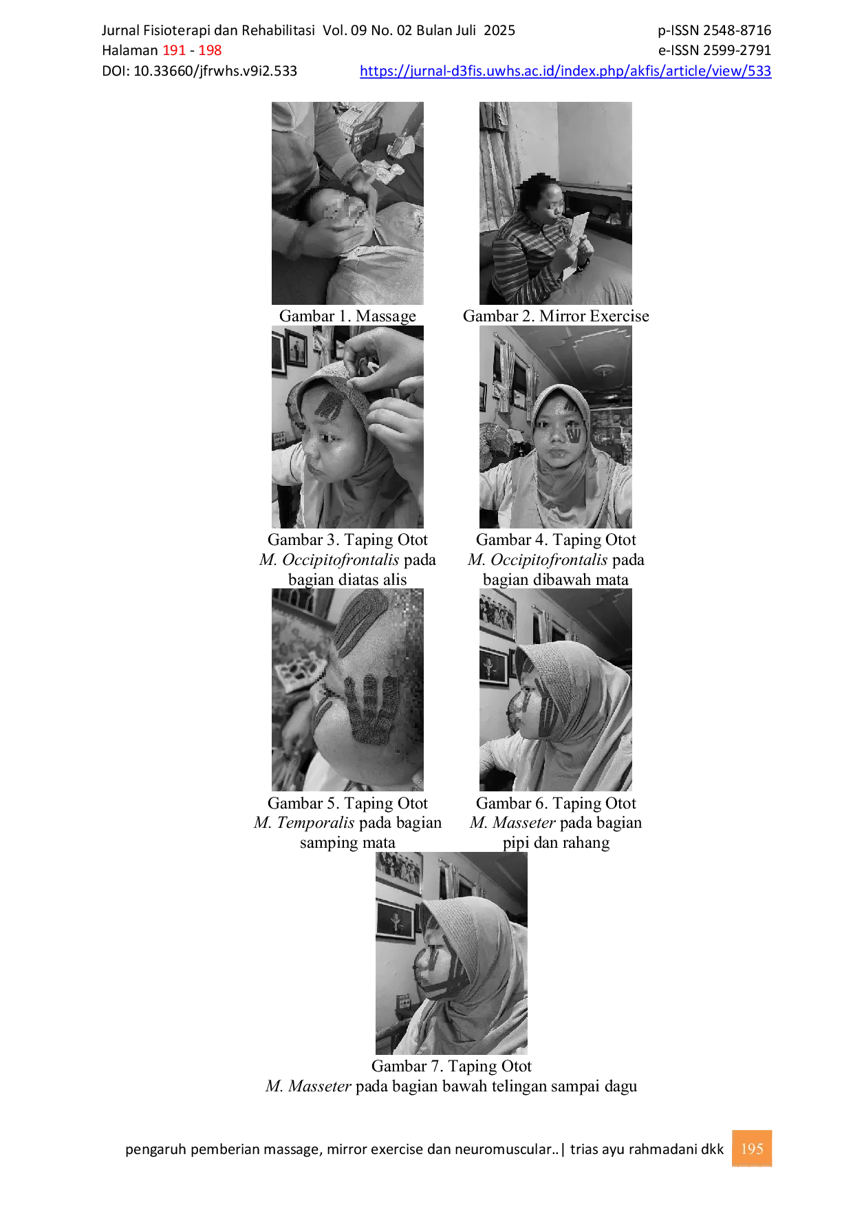JURIS Pengaruh Pemberian Massage Mirror Exercise Dan Neuromuscular Tapping Pada Kasus Bell s Palsy Case Report