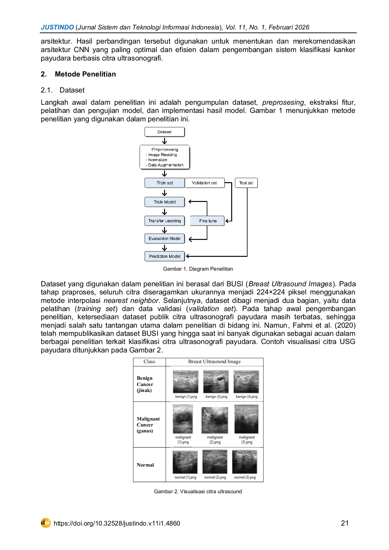 JURIS Ultrasound Image Classification of Breast Cancer Using MobileNet