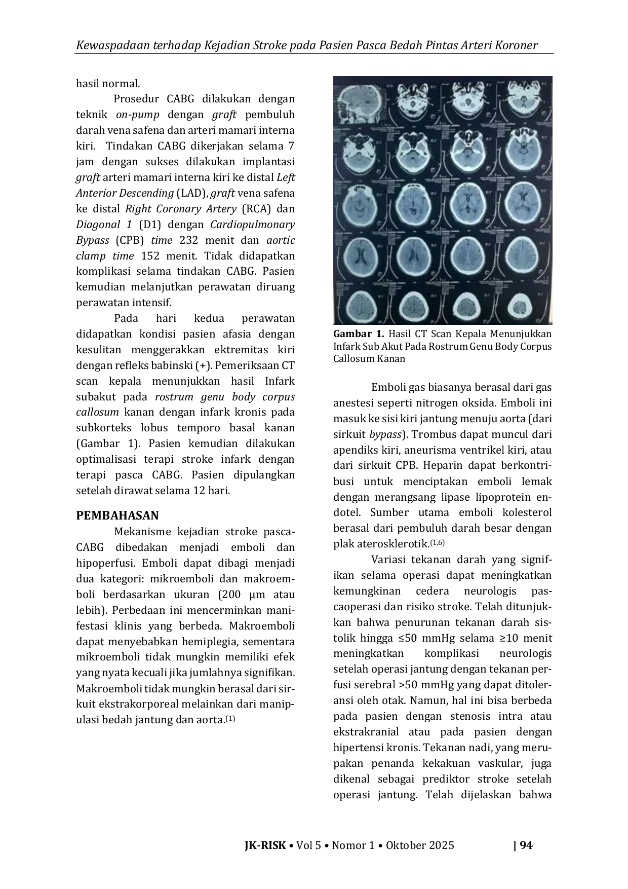 JURIS Awareness of Stroke Incidence in Post CABG Patients