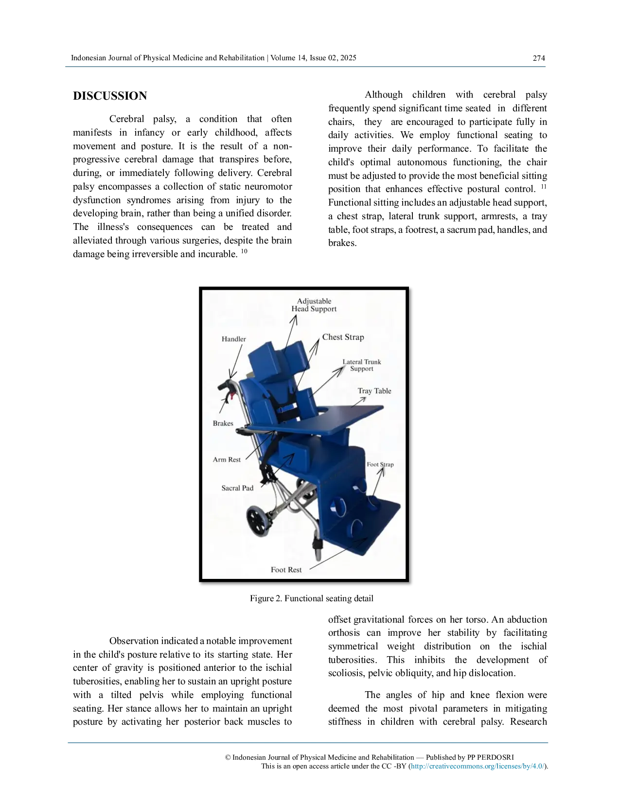 JURIS Functional Seating to Enhance Mobility and Activity in a Child with Spastic Quadriplegic Cerebral Palsy