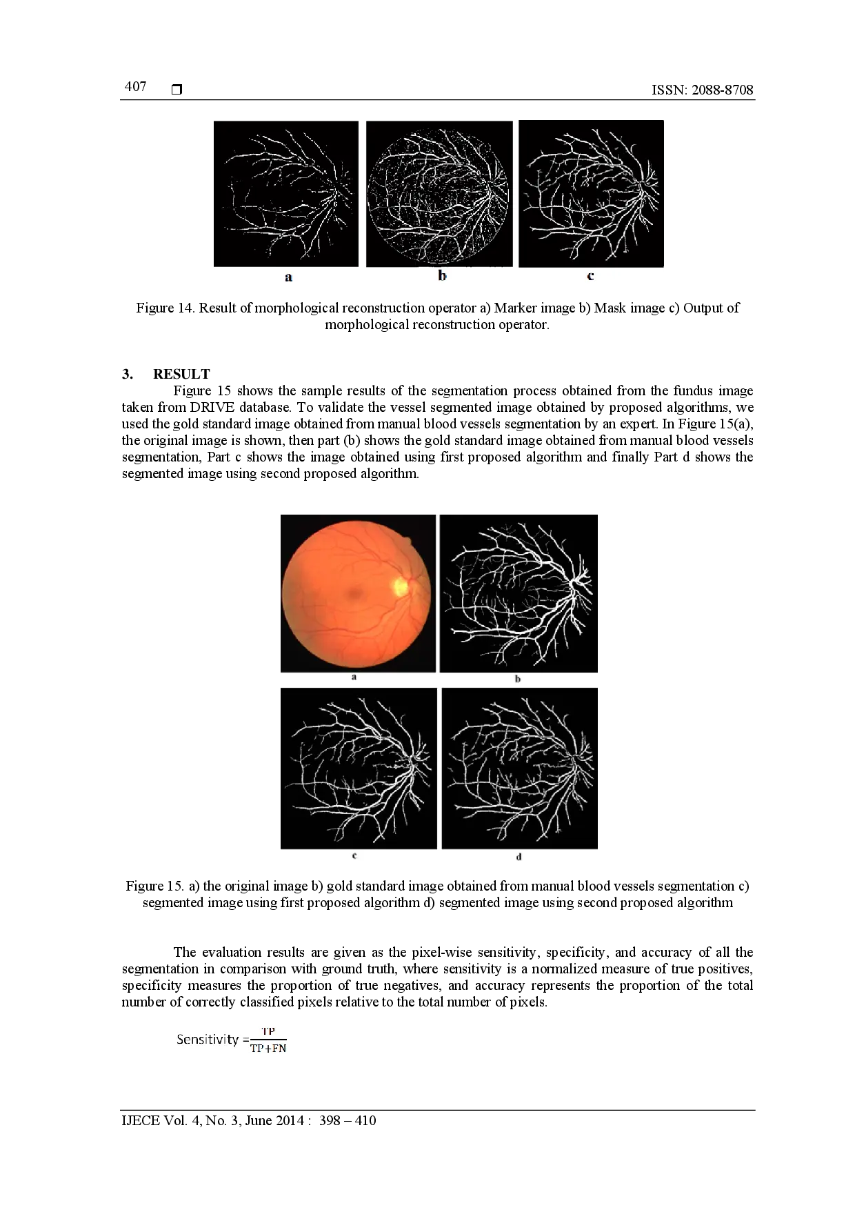 juris Two Novel Retinal Blood Vessel Segmentation Algorithms