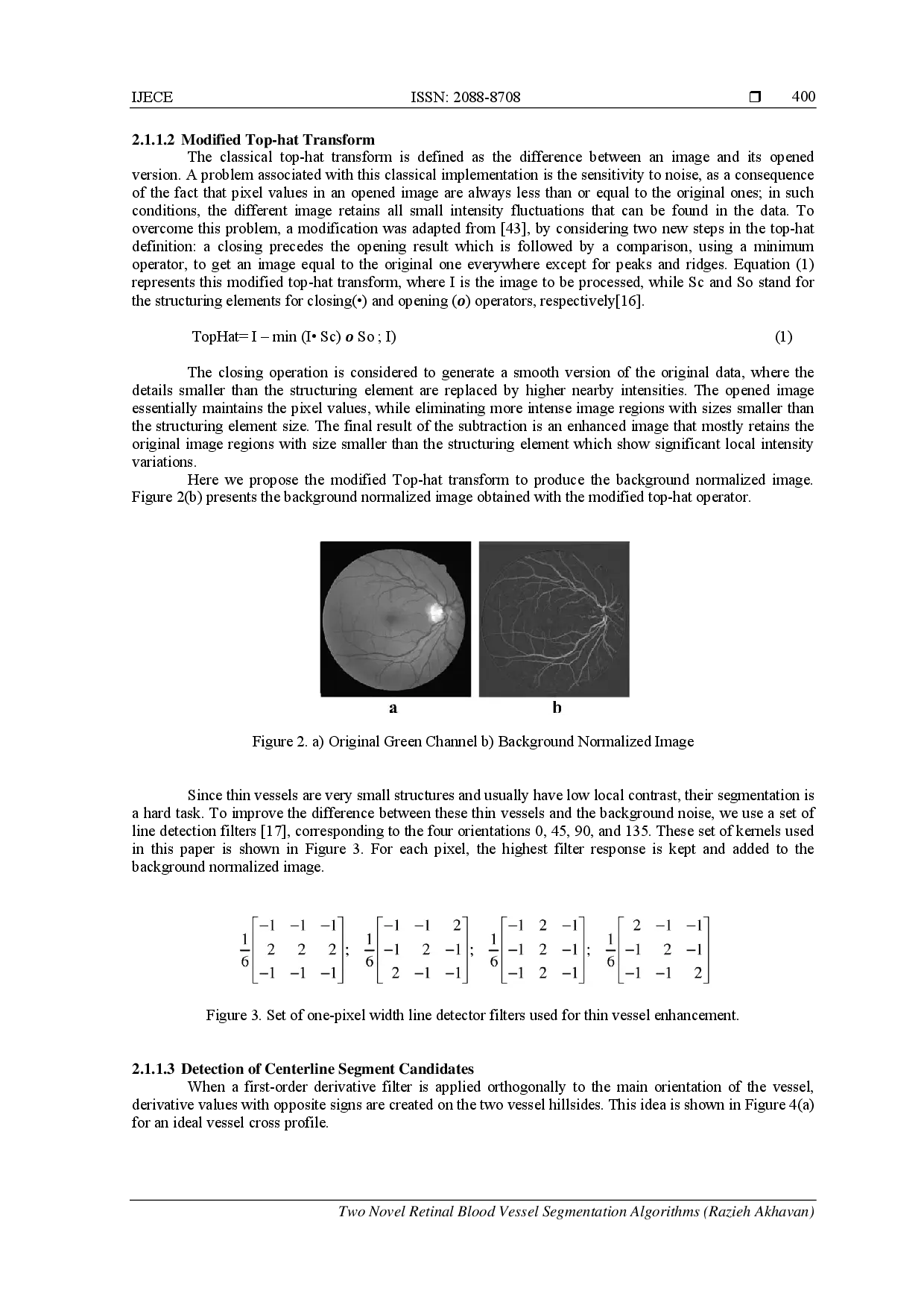 juris Two Novel Retinal Blood Vessel Segmentation Algorithms