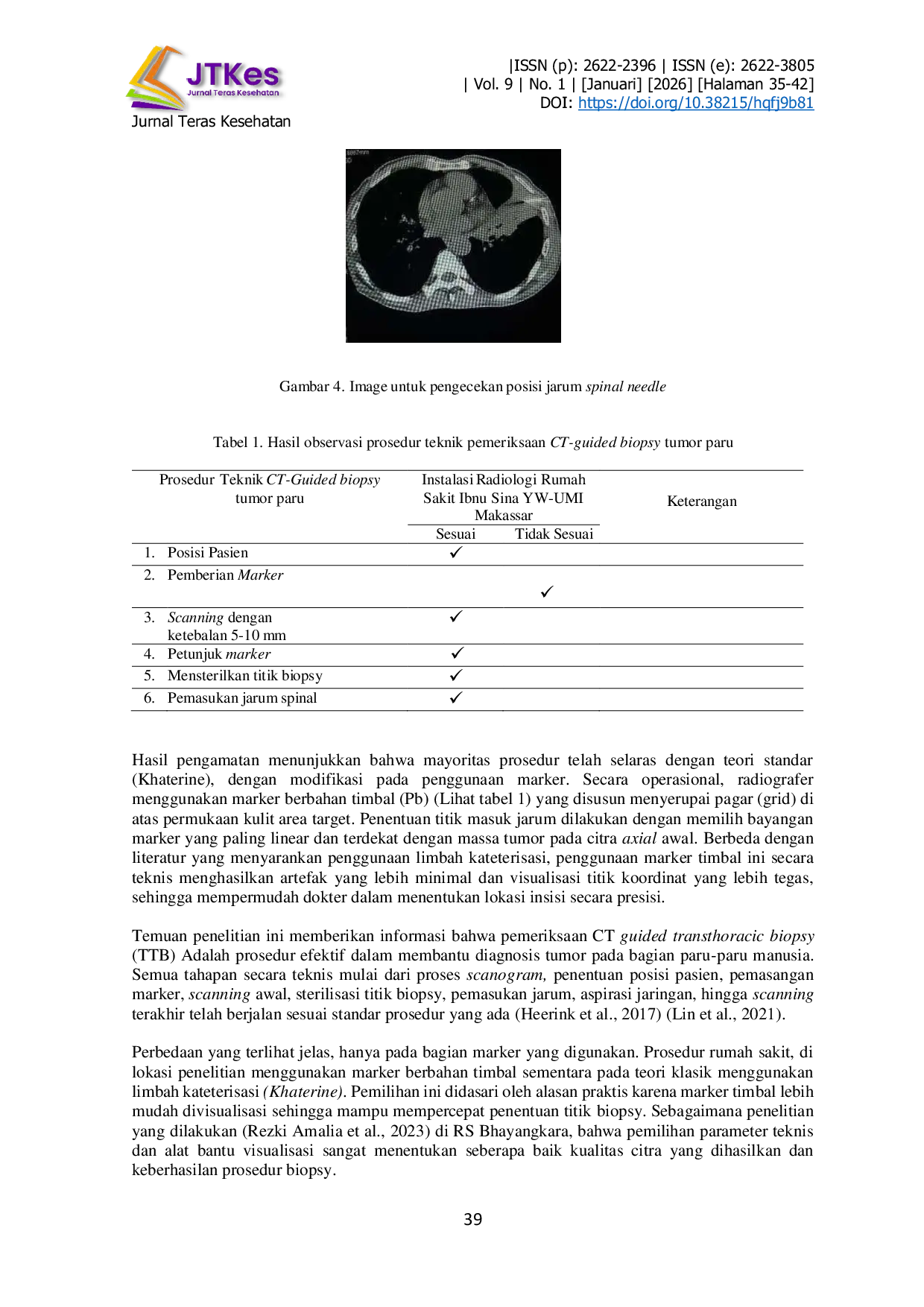 JURIS Prosedur Teknis Biopsi Paru Menggunakan Panduan CT Scan Thorax