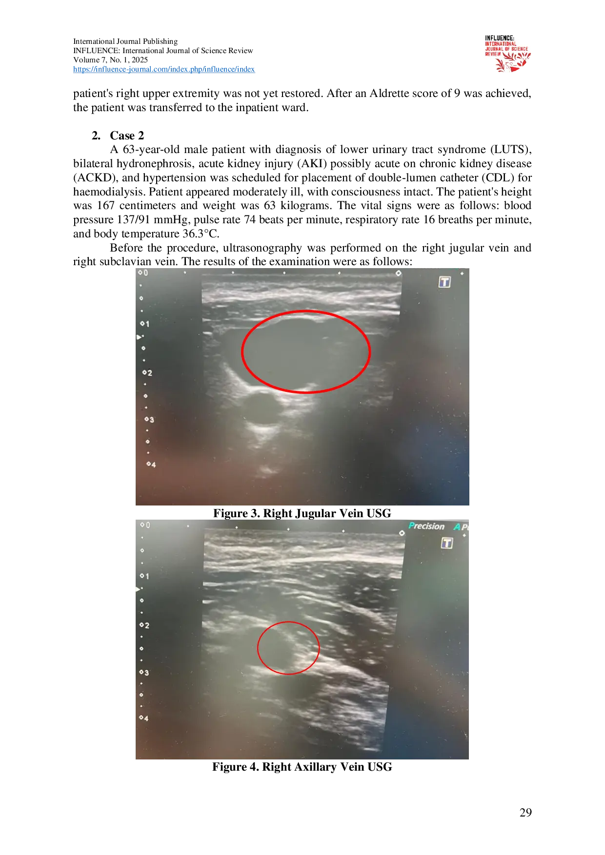 JURIS The Role of Pre Procedural Ultrasound Examination for Anesthesia Case Series