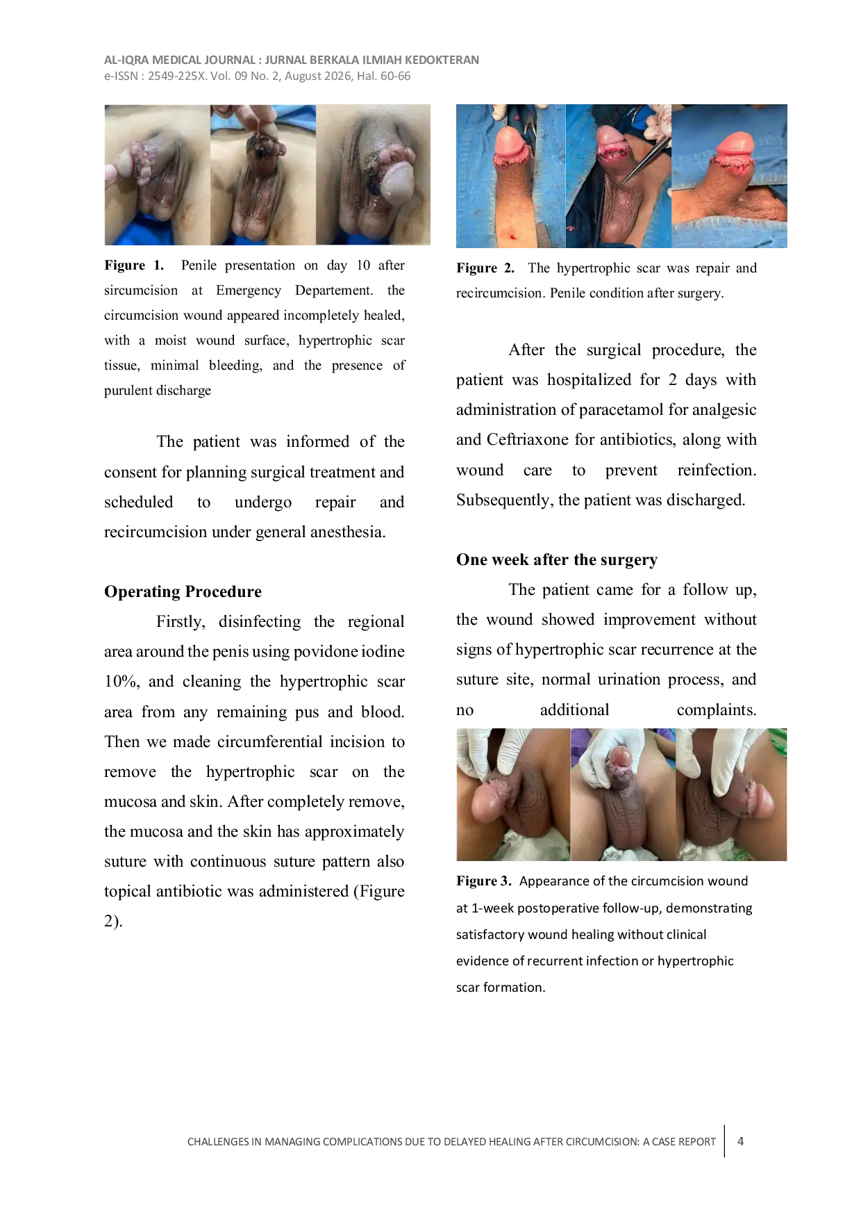 JURIS Challenges In Managing Complications Due To Delayed Healing After Circumcision A Case Report