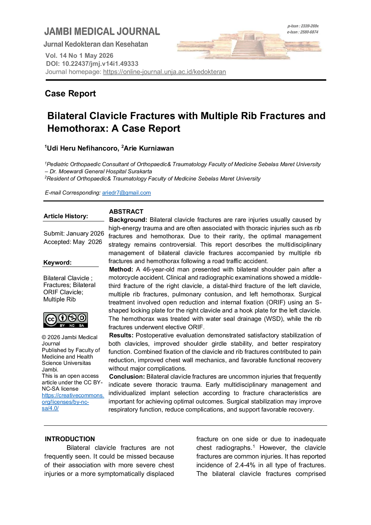 JURIS Bilateral Clavicle Fractures with Multiple Rib Fractures and Hemothorax A Case Report