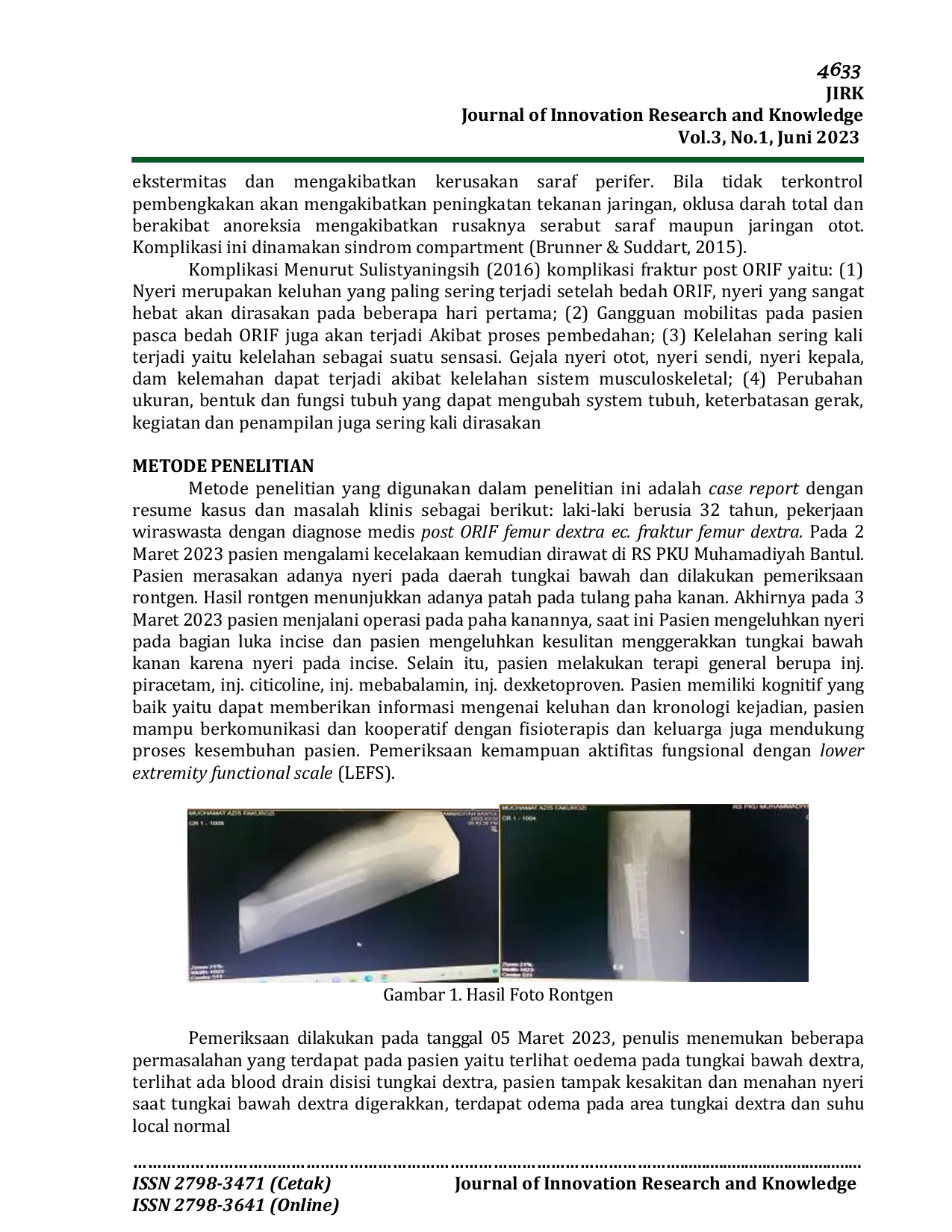 JURIS Management Penanganan Fisioterapi Pada Kasus Post Orif Femur Dextra Ec Fraktur Femur Dextra Di Pku Bantul Yogyakarta