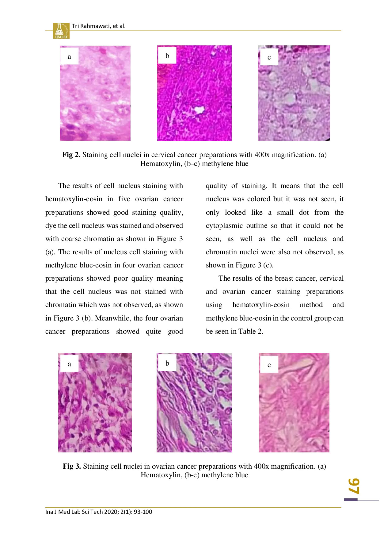 juris Utilization of 1 of Methylene Blue in Staining Histopathological Preparations at Anatomic Pathology Laboratory