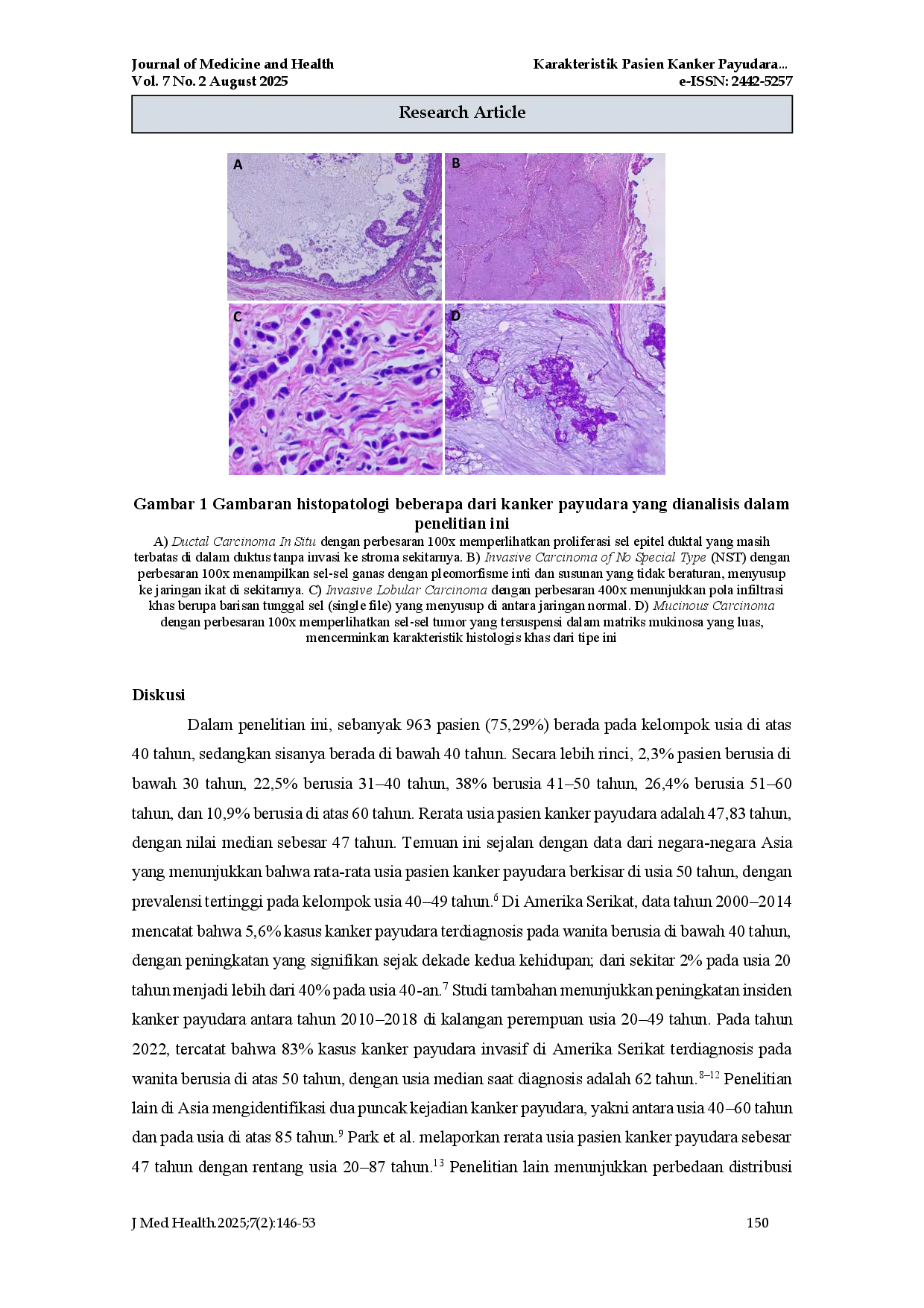 juris Characteristics Of Breast Cancer Patients In RSUD Arifin Achmad Pekanbaru In 2017 2021