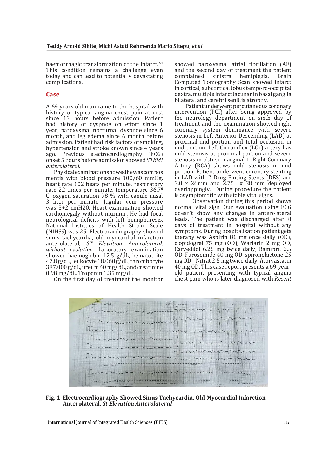 JURIS Review on Acute Cardio Cerebral Infarction a Case Report